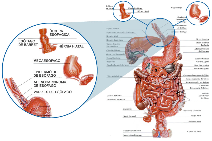 Anatomia do esôfago