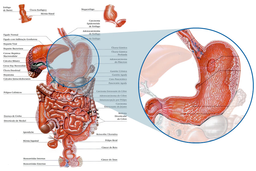 Anatomia do estômago