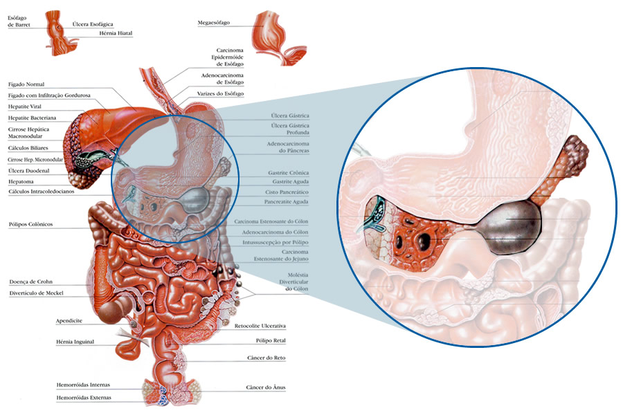 Anatomia do pâncreas