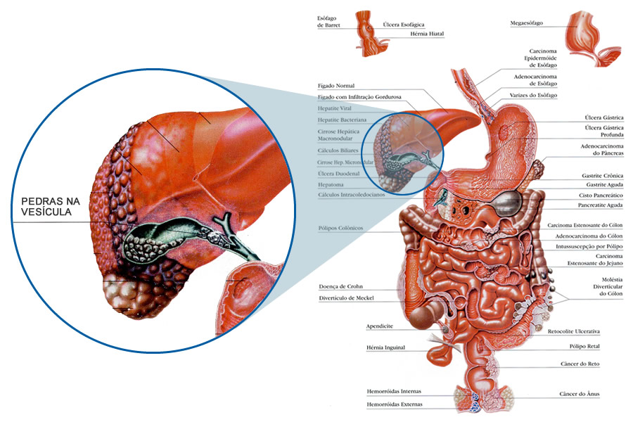 Anatomia da Vesícula Biliar